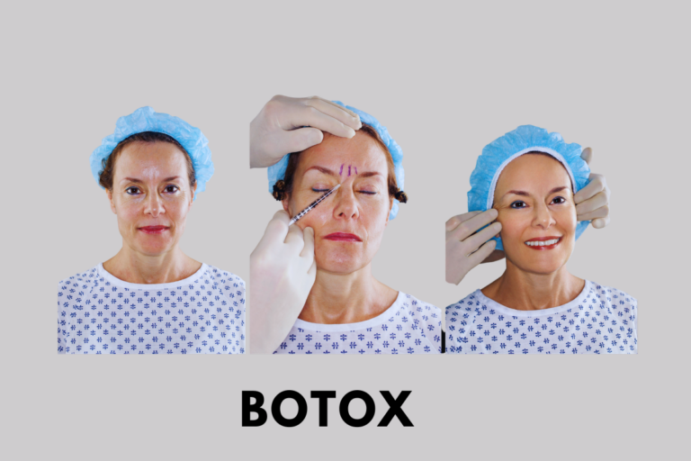 Botox
